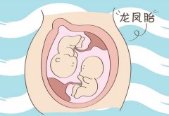 μ̥ μ̥ʲôԤ μ̥ò